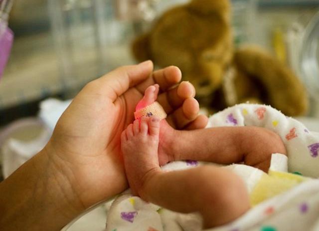 Photo of a premature infant and mother