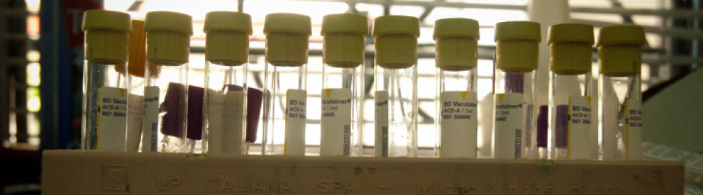 A photo of HIV study test tubes